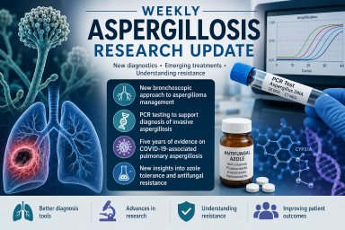 Medical illustration showing Aspergillus fumigatus, PCR diagnostics, lung imaging, antifungal medicines and laboratory research representing recent advances in aspergillosis diagnosis, treatment and antifungal resistance research.