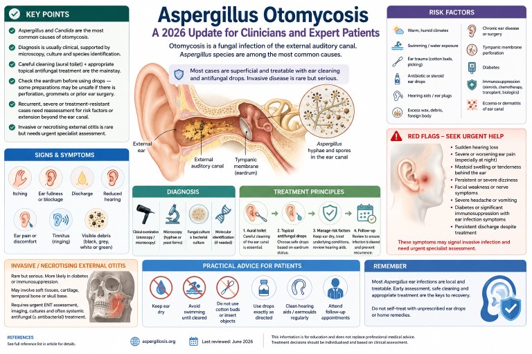 Medical illustration showing Aspergillus otomycosis, a fungal infection of the external ear canal, including fungal debris, symptoms, diagnosis and treatment principles.