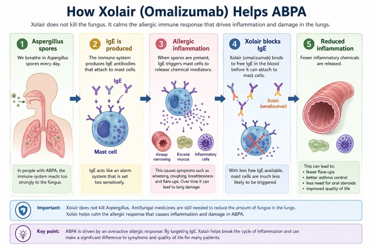 Illustration showing how Xolair (omalizumab) treats allergic bronchopulmonary aspergillosis (ABPA) by blocking IgE antibodies and reducing allergic inflammation in the lungs.