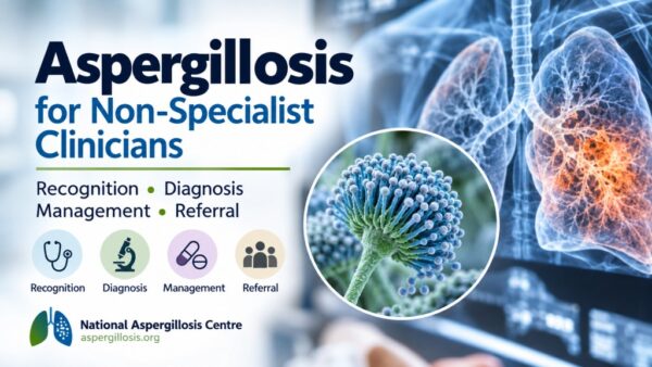 Aspergillosis guide for non-specialist clinicians covering recognition, diagnosis, management and referral